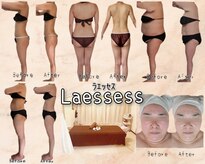 ラエッセス(A Laessess)