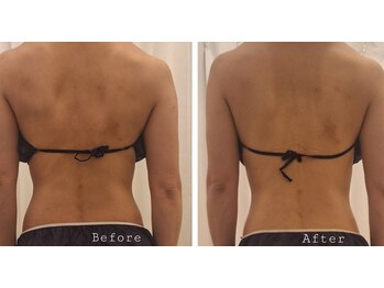 ナチュラ(Natura)/バザルトボディ!