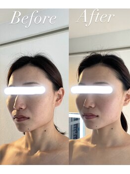 サロンドベベ(salon de Bebe.)/お客様ビフォーアフター