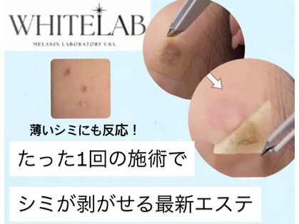 アーレ 博多本店(ARE)の写真