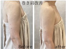 グランツ(glanz)の雰囲気(骨格矯正×リンパ促進整体で美姿勢#巻き肩#猫背#反り腰#肋骨開き)