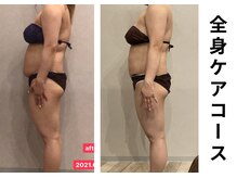 プラマイル(Pramile)/全身ケアコース