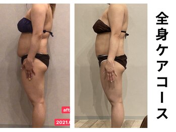 プラマイル(Pramile)/全身ケアコース