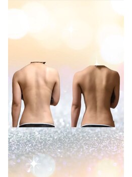 ヨサパーク ゴールデンツリー 浦安本店(YOSA PARK GordenTree)/天使の羽クッキリ!