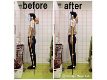 上本町骨盤整体院グッド/「整体による姿勢の変化」