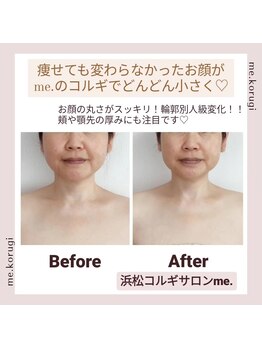 ミードット(me.)/痩せても変わらなかったお顔も☆