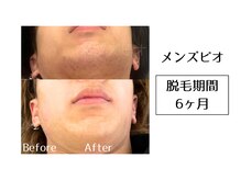 メンズビオ 神戸三宮店/