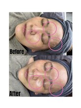 リル(Rire)/Before→After　50代