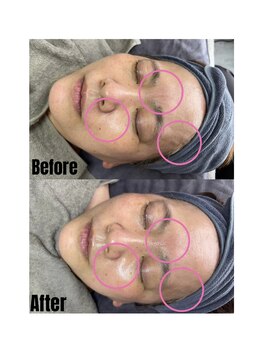 リル(Rire)/Before→After　50代