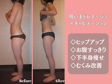 エステティックサロンティエリーの雰囲気（脚長効果・ヒップUP◎ハンドとの違いをご体感ください♪）