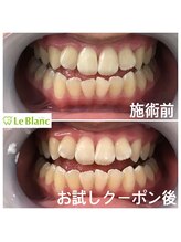 ルブラン 奈良店(Le Blanc)/一度お試し下さい！！