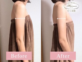 ロココ つくば店(Rococo)/BEFORE/AFTER