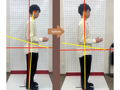 ホネツギ 柏駅西口接骨院(HONETSUGI)の写真