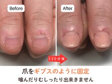 ネイルサロン プロムナード(nailsalon promnade)/噛んだりむしったりを防止