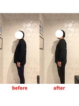 ナオル整体 福岡香椎院(NAORU整体)/40代男性施術事例【姿勢不良】