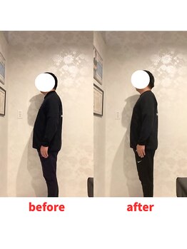 ナオル整体 福岡香椎院(NAORU整体)/40代男性施術事例【姿勢不良】