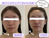 アクアンジュ(Aquange)