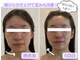 アクアンジュ(Aquange)の写真