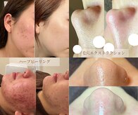 サロンステラ(SALON STELLA)