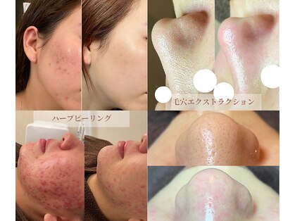 サロンステラ(SALON STELLA)の写真