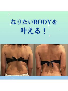 マーガレット(Marguerite)/SecretMes痩身