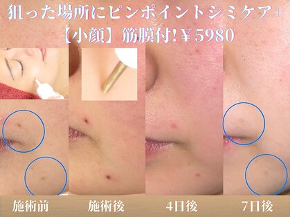 アイリープ(eyeleap)の写真