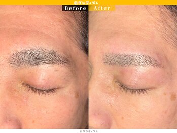 眉ダンディズム 大阪天神橋六丁目店/THE！平行眉毛！