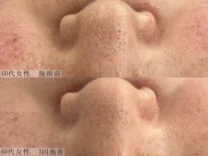 ヴェルシック(Belchic)の写真