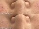 ヴェルシック(Belchic)の写真