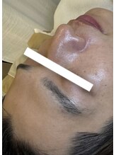 アース 目黒店(Earth)/メンズのお肌も毛穴洗浄