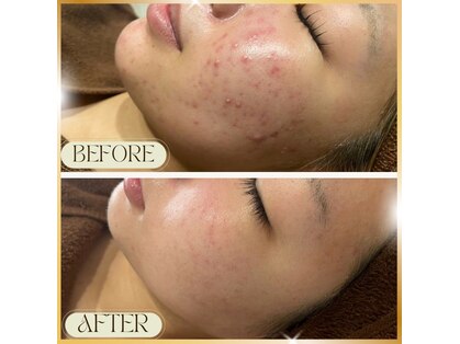 ノット(knote)の写真