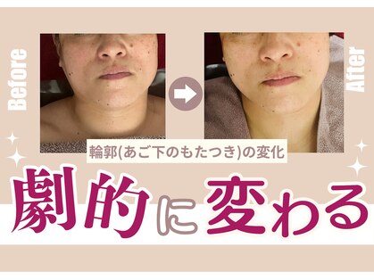 ココリラ(cocorela)の写真