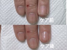 アメジスト(Amethyst)/自爪育成ケア！見た目の印象UP