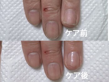 自爪育成ケア！見た目の印象UP