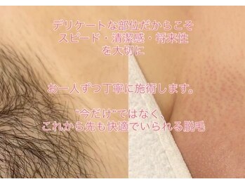 パシト(pasito)/人気のワックス脱毛VIO/MIX脱毛