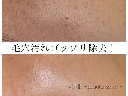ウェヌ(VENE)の写真