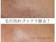 ウェヌ(VENE)の写真