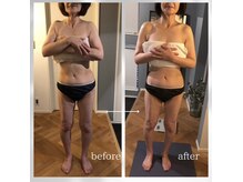 ナルエステティック(NARU.esthetic)の雰囲気（ボディーラインを整え体のたるみ改善も人気。痩身、歪み、痛みに）