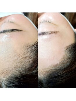 パーソナルアイラッシュ(PERSONAL EYELASH)/ひたいワックス