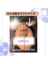 フルブルーム(Full Bloom)/小顔フェイシャル