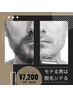 【MENS脱毛/サロン脱毛トップレベル効果】LED脱毛"Lパーツ"¥8000→¥7200