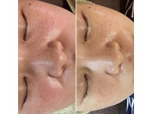 プリンセスモモ 佐世保白岳店(Princes Momo)/ビフォーアフター