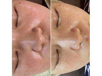 プリンセスモモ 佐世保白岳店(Princes Momo)/ビフォーアフター