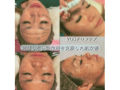 リゲル ザ ベスト(RIGEL the best)の写真