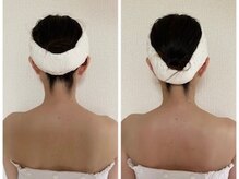 ル シエル(Le Ciel)/40代/後ろ姿/左before右after