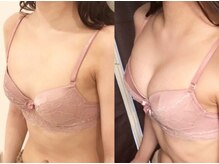 スマイルクルー(SmileClue)/ビフォーアフター症例