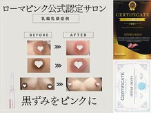 スノースキン(Snow skin)の雰囲気（ローマピンクの偽物多発注意★AC3本+ヒアルロン酸導入プレゼント）