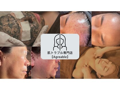 アーブル(Agreable)の写真