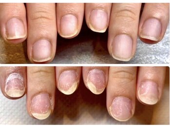 ビビネイル(BIBI Nail)の写真/【美爪育成サロンの本格爪育プランが大人気!!】教育関係・飲食系・お爪にコンプレックスをお持ちの方必見☆