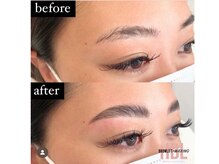 ラビット(Lovit)/ハリウッドブロウリフト